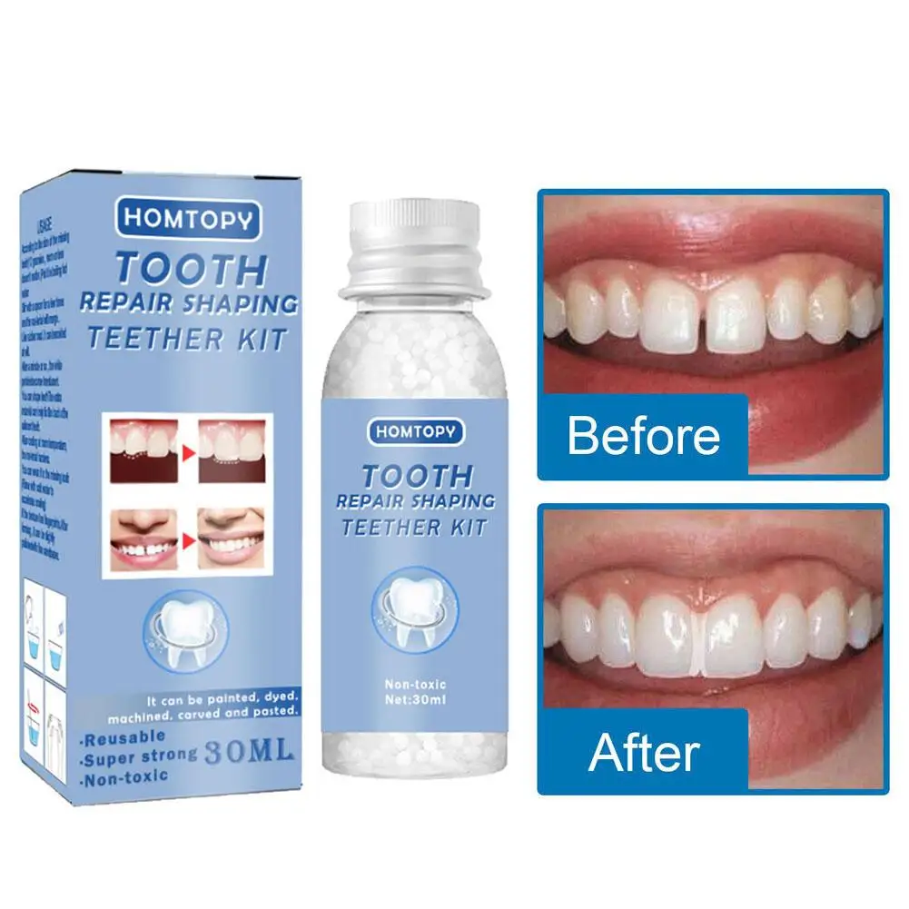 

30ml Oral Fake Teeth Filling Glue Repair Temporary Filling Tooth 2023 New False Kit Dental Dentures Teeth Teeth Shaping Kit K2O2