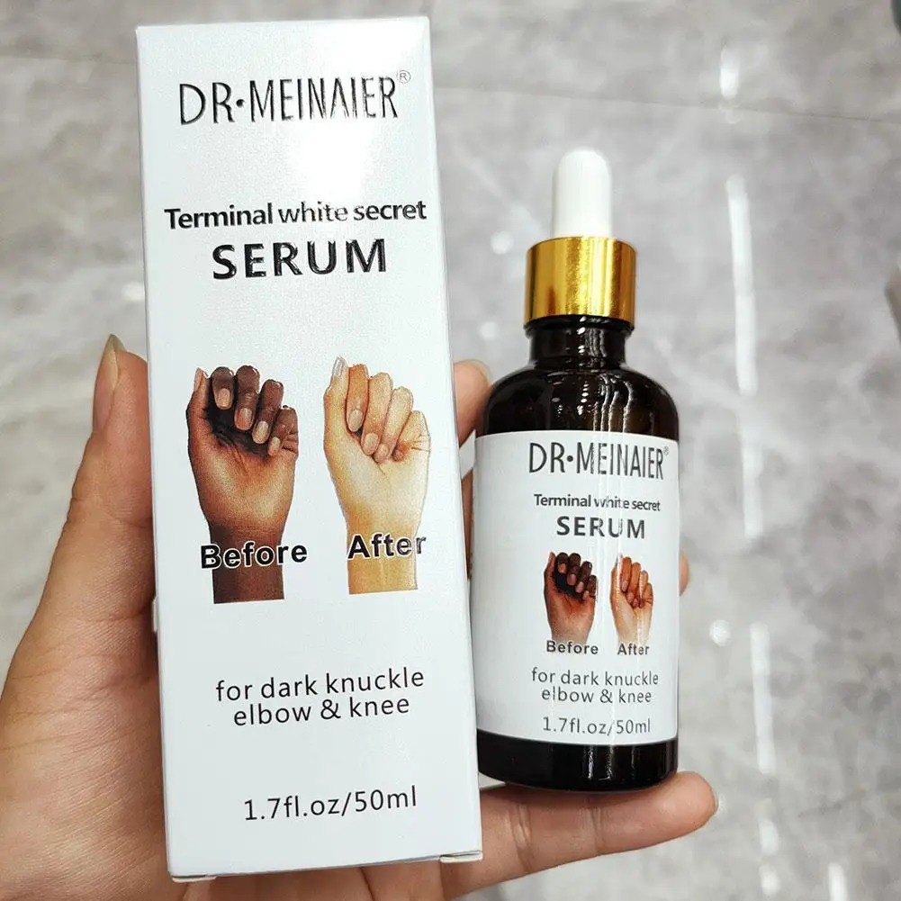 

50ml Whitening Serum Hand Knuckle Glow Serum For Removing Dark Knuckle Elbow And Knee Strong Dark Knuckle Serum Body Essence New