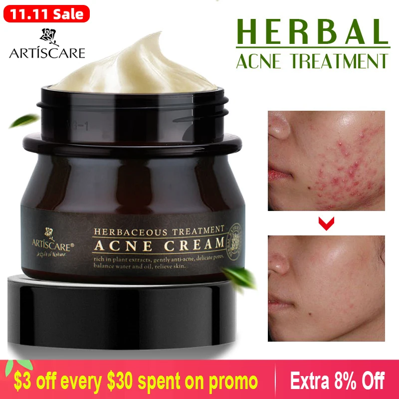 Artiscare Herbal Acne Treatment Facial Cream For Acne Skin Care Face
