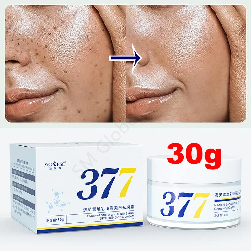 thumbnail image 1 of 377 Crema blanqueadora para pecas, aclara las manchas oscuras, mejora el tono de la piel opaca, loción iluminadora hidratante para mujeres y hombres, novedad de 2024, 1 of 5