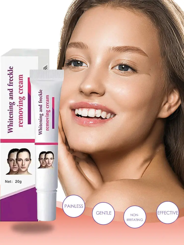 Freckles removal cream remove facial spots skin dark spot remove