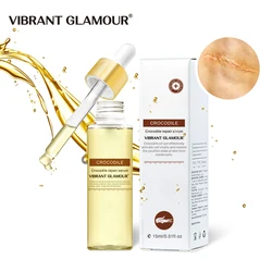 VIBRANT GLAMOUR Crocodile Repair Scar Serum Acne Treatment Stretch Marks Removal Acne Scar Whitening For Spots Skin Care 15ml