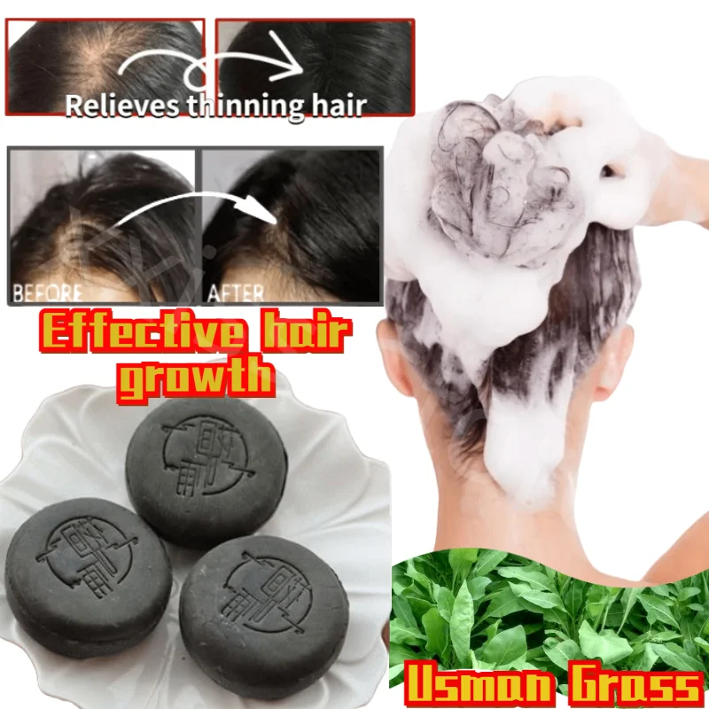 

Usman Grass Shampoo Soap Amino Acid Shampoo Soap To Prevent Hair Loss and Effectively Grow Hair Shampoo for Hair Growth