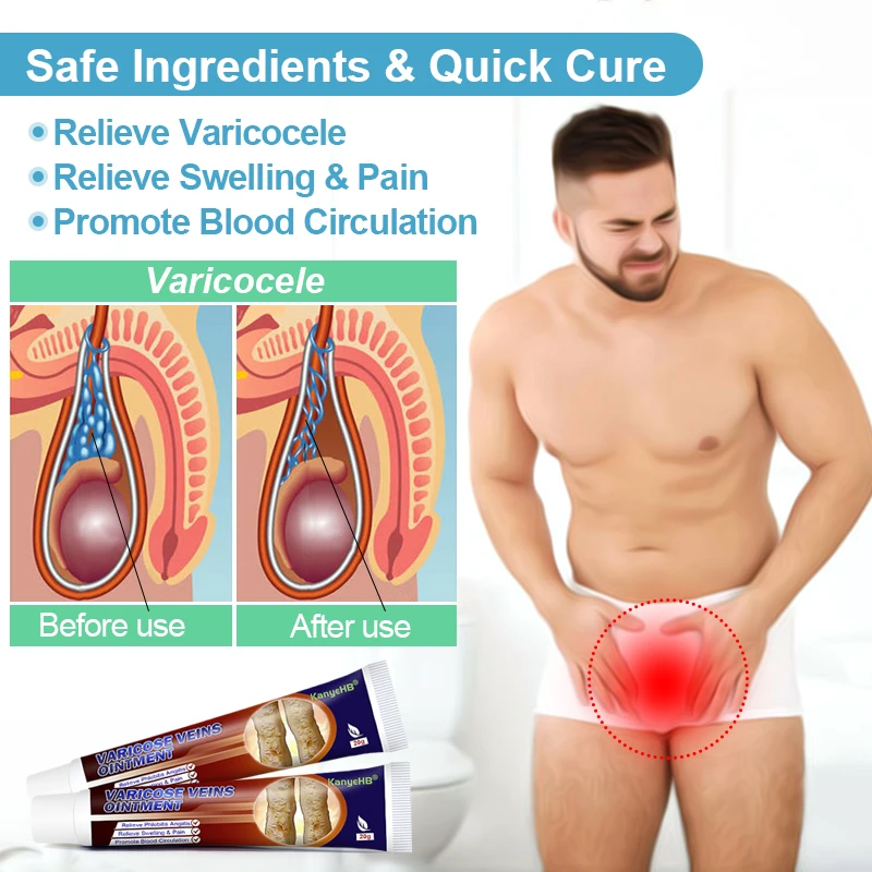 Men's Varicose Vein Ointment 1pcs Groin Pain Varicocele Cream Scrotum Swelling And Pain Improve Decreased Sexual Function G010 pain relief cream skin care ointment