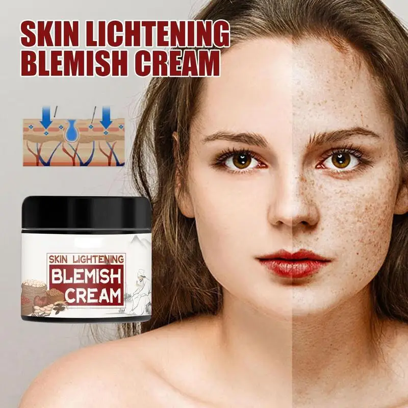 Become Beauty Ginseng Extract Whitening Cream Remove Freckles Whitening Freckle Spots Cream