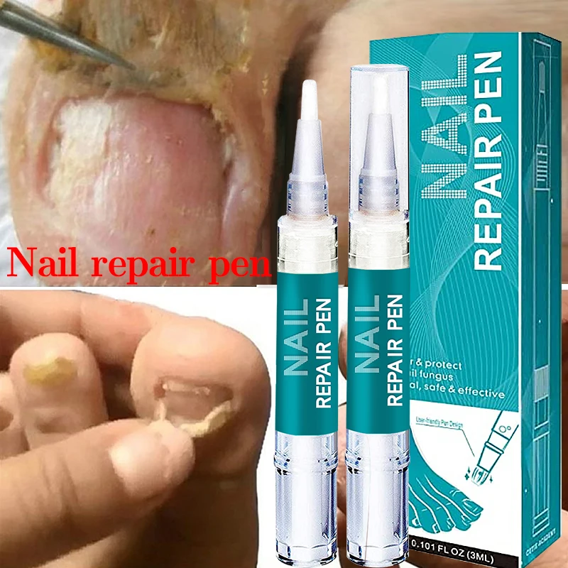 

3 ML Nail Repair Liquid Pen with Brush Gentle Anti Fungal Remover Onychomycosis Paronychia Foot Nail Fungus for Nails Manicure