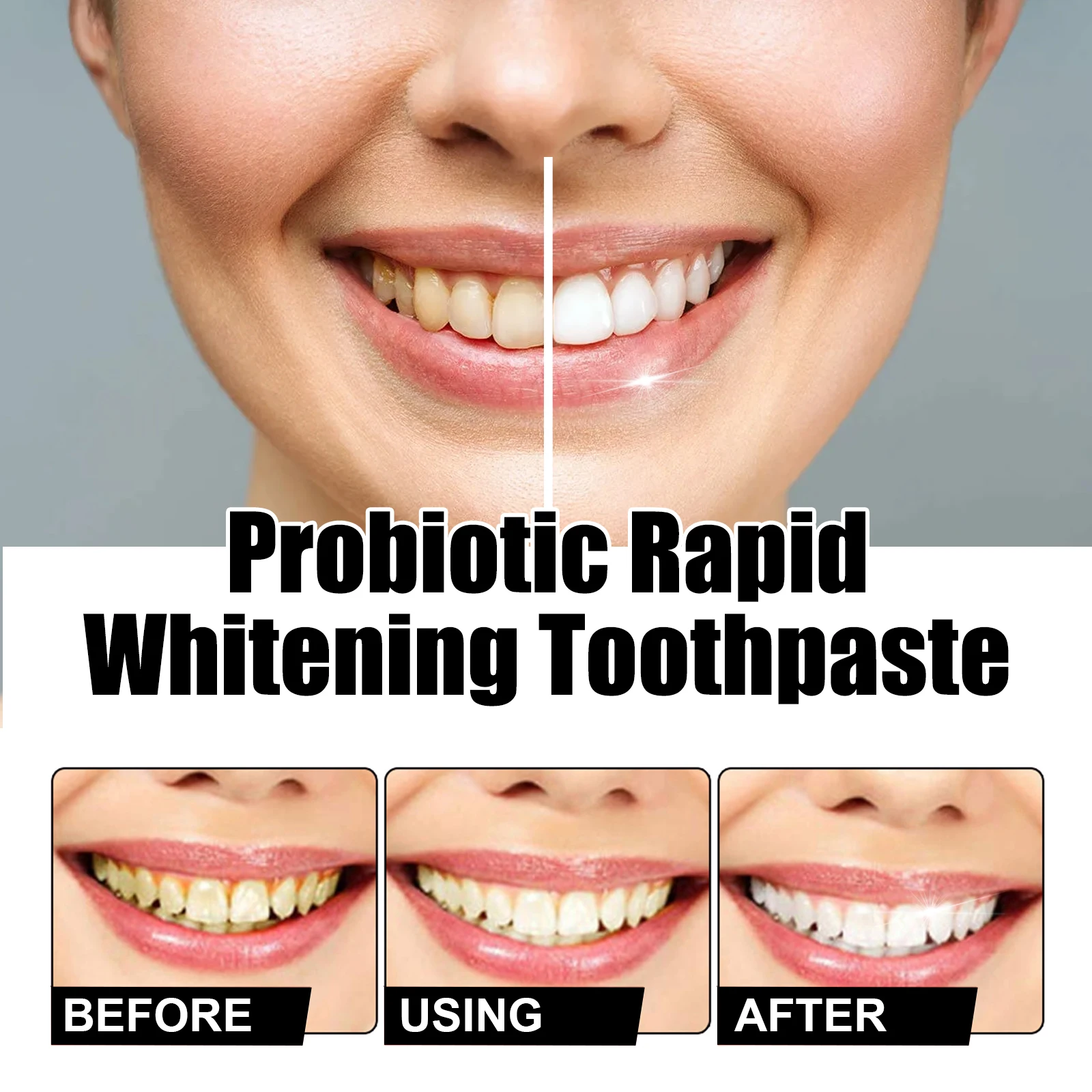 Oralhoe probiotic whitening toothpaste,Oral cleaner,Tooth Color Correction,Care For Oral Health Teeth Whitening Toothpaste