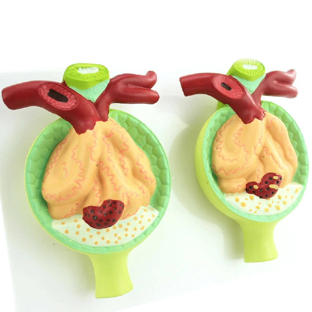 Medical proteinuria model Human kidney model Renal corpuscle Urology Department anatomy models