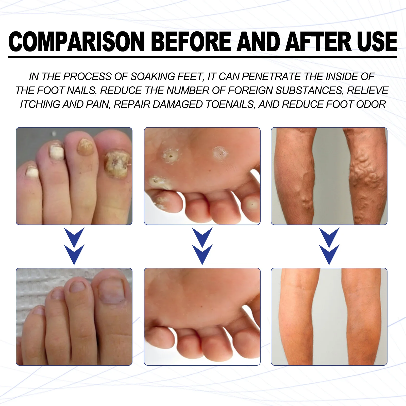 Foot Detox Cleansing Soak Beriberi Removal Nail Antibacterial Heel Anti Crack Relieve Fatigue Swelling Herbal Soothing Foot Bath