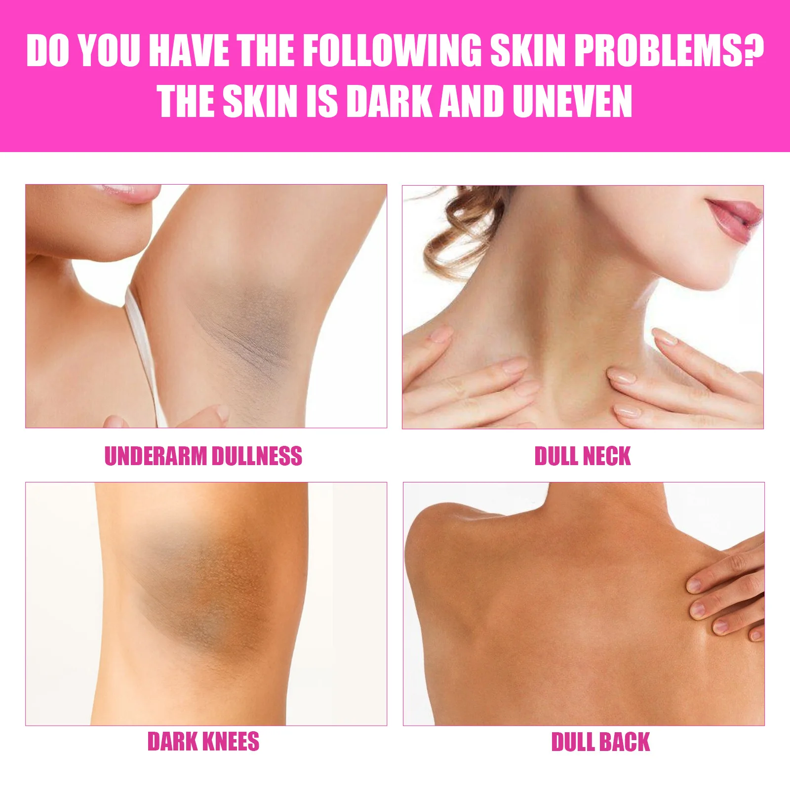 Whitening Cream Knee Buttock Inner Thigh Bleach Remove Melanin Dullness Fade Dark Spots Nourishing Underarm Brightening Cream 3