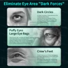 3D Eye Massager Eyes Microcurrent Pulse Relax Fatigue Relief Lighten Dark Circles Smooth Eye Fine Line Beauty Skin Eye Care 2