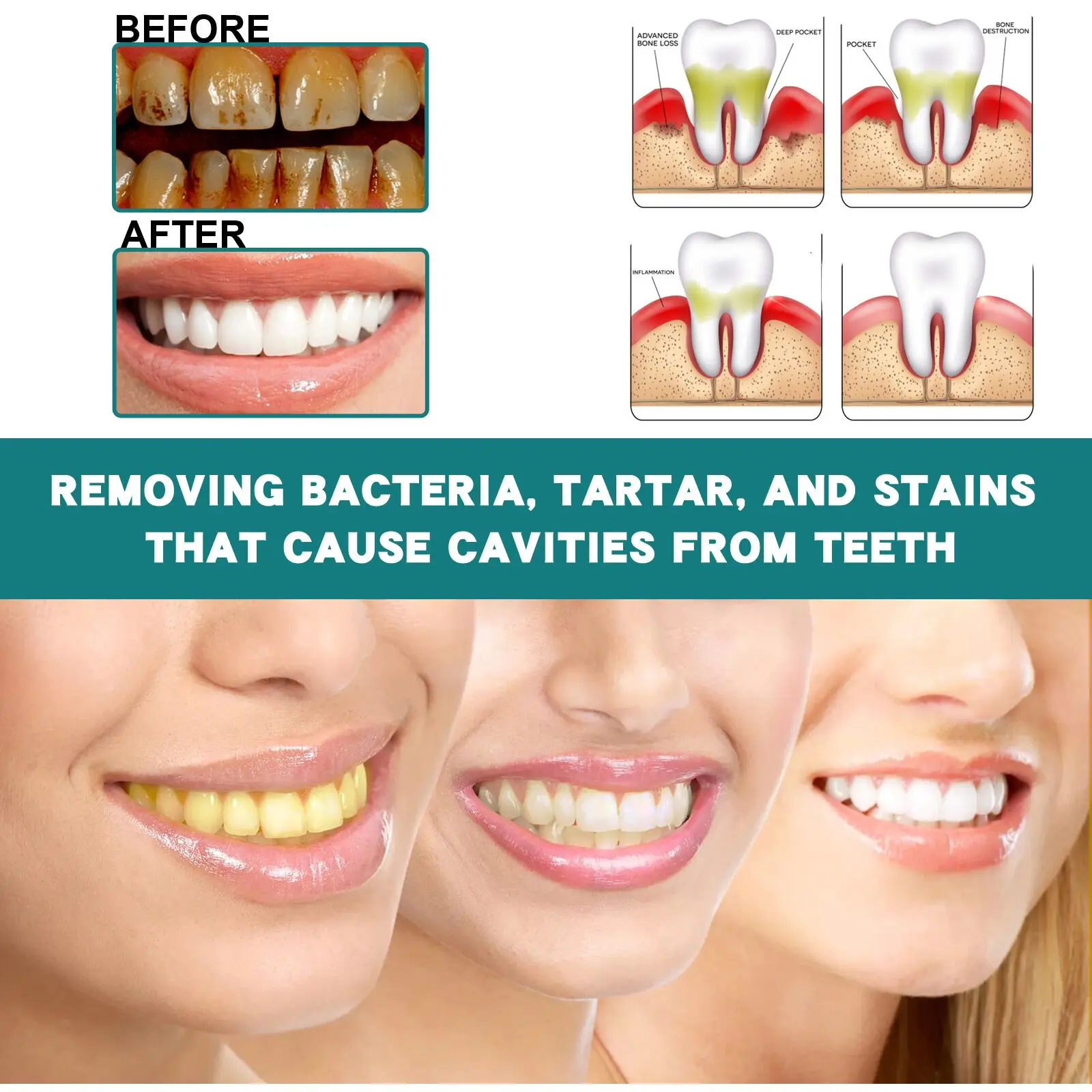 Tooth Whitening Jaysuing Repair Liquid Cleansing Stains Stains, Yellow Tooth Stains, Tooth Stains, Tooth Stains is most effective_voghion.com
