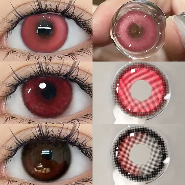 Ring around eye? Has something to do with contacts, takes prescription  drops but it eventually comes back , could it be the solution? : r/optometry