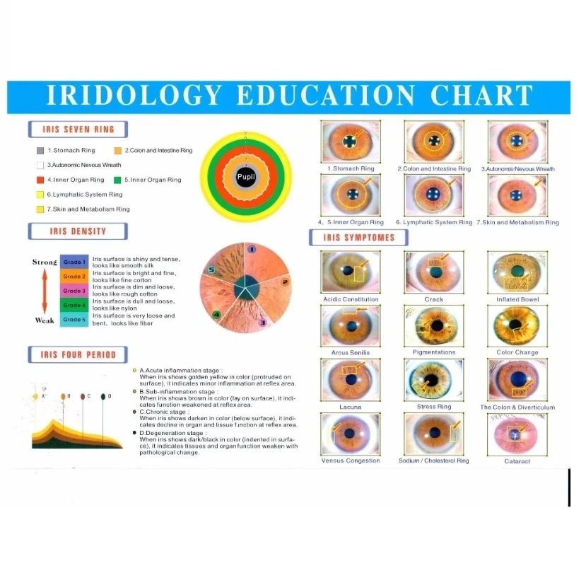 Professional Iridology Digital Cameras Multifunction 12MP Camera Eye Iris Scanner Iris Iriscope Analyzer Body Health Diagnosis - 5