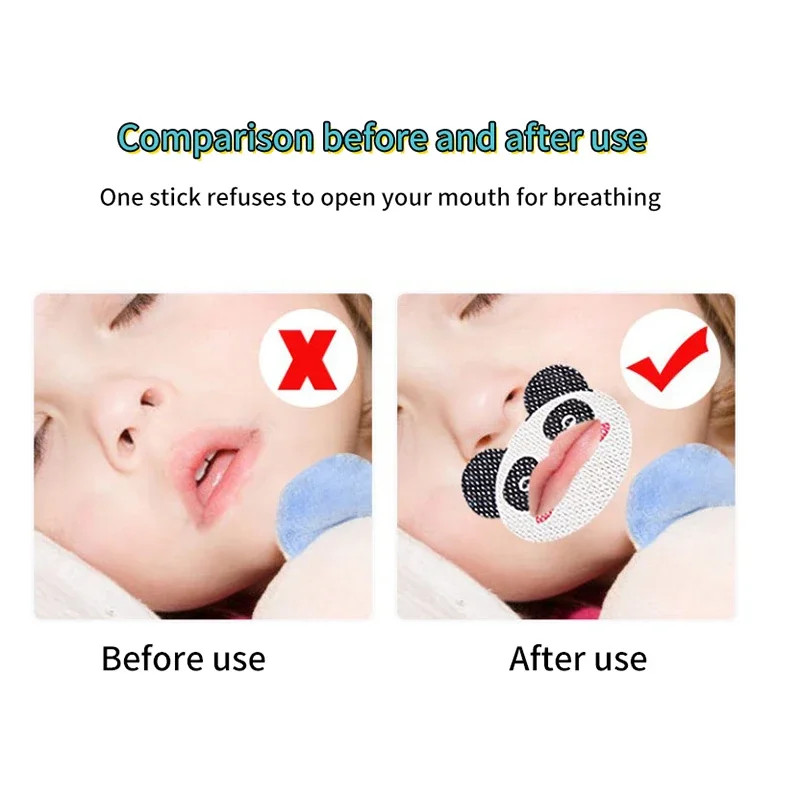 Kids Cartoon Anti-Snoring Stickers Sleeping Closed-mouth Stickers Breathing Correction Patch 30PCS stop snoring patch,anti snoring patch,sleeping patch