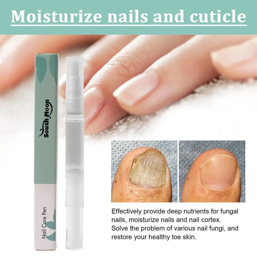 Anti-Fungal Nail Pen Dispel Leuconychia Liquid Remove Repair Pen Fungus Onychomycosis Care Serum Care Tools Repair Nail Toe V1Q5