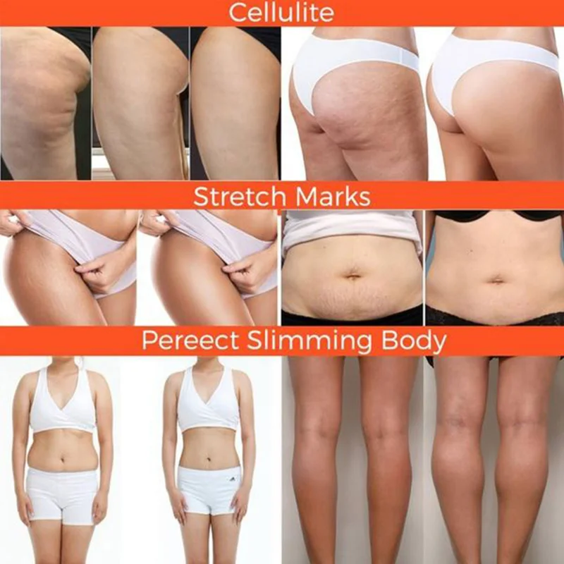 Crema modellante per il corpo della pancia Crema snellente Brucia grassi Crema dimagrante Anticellulite Slime Anti-obesità Sano e sottile -Obesità_voghion.com