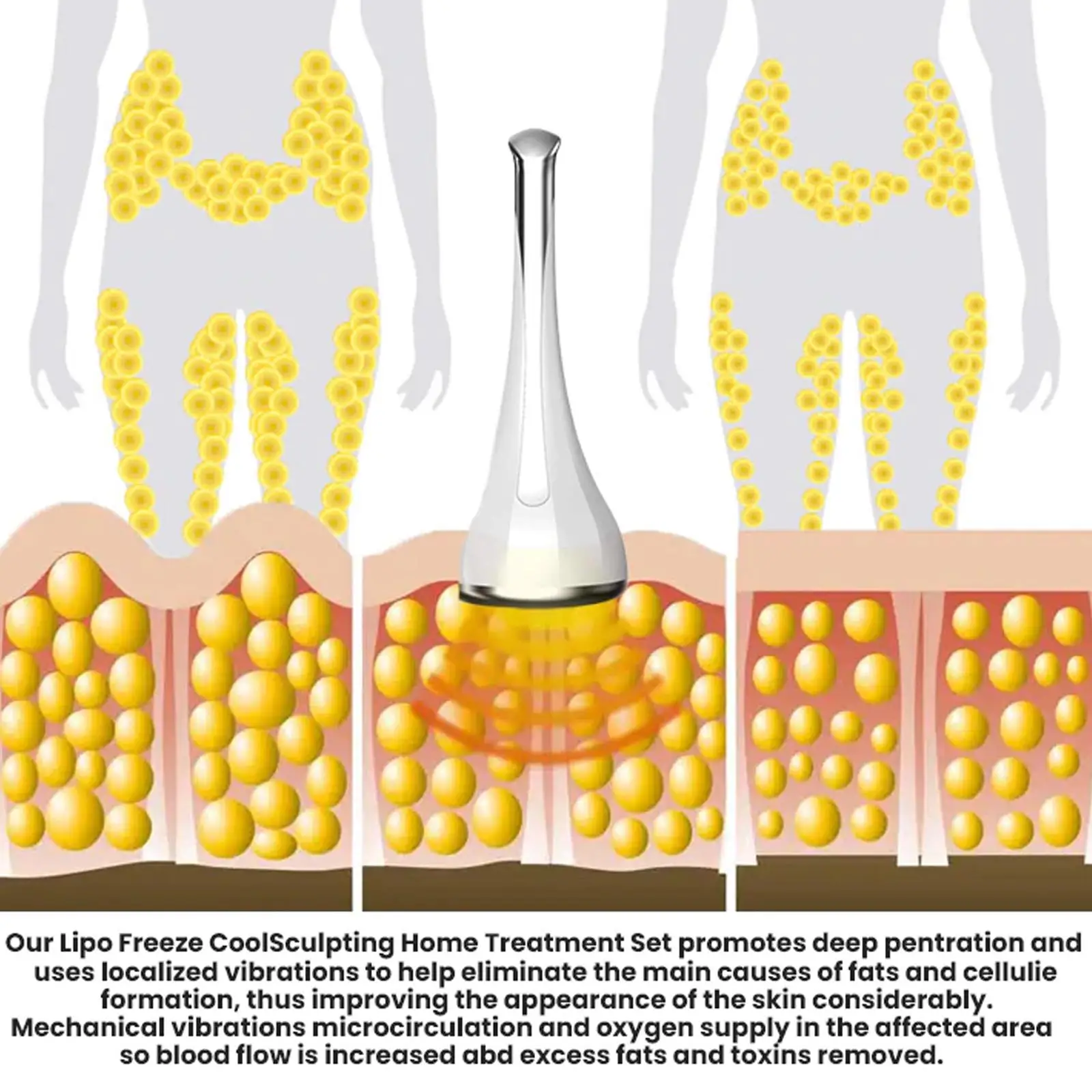 Ice pack Membrane Anti gel pour Machine à congélation de graisse