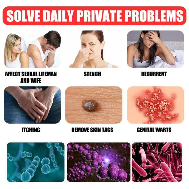 Wart Remover Ointment Vulva Herpes Genital Wart Condyloma Acuminatum