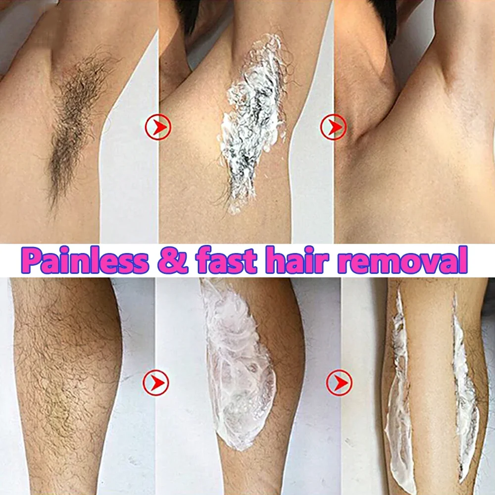 Hair Removal Cream Permanent Epilator Cream Intimate Areas Health Painless Hair Remover Growth Inhibitor for Men Woman Body Care 2
