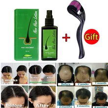 

Hair Growth Herbal 100% Natural Healing Spray Stops Hair Loss and Removes More Nutrients From Root Hair Loss Products