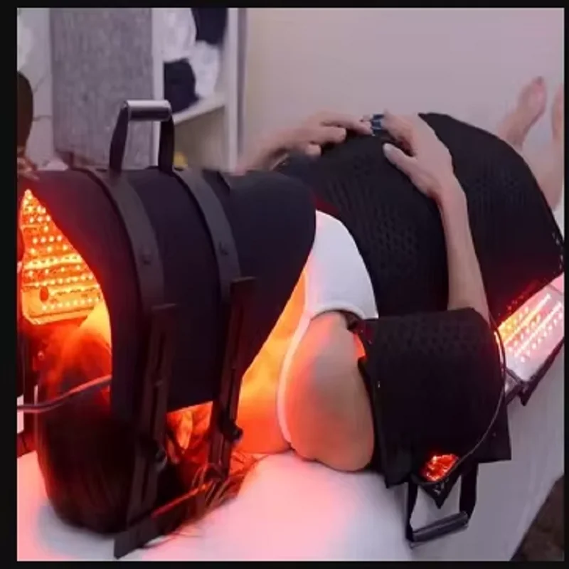 lipolysis laser
