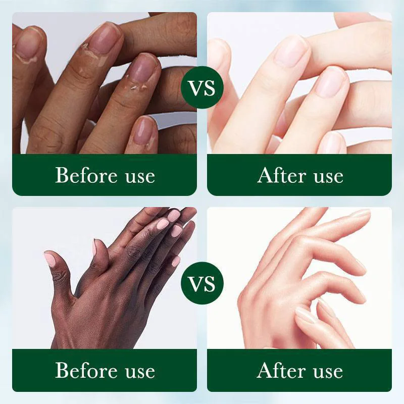 Dark Knuckles Fast Brightening Serum Hand Anti Cracking Cream Fingers Brighten Moisturiz for Dark Skin Stains Remover Products