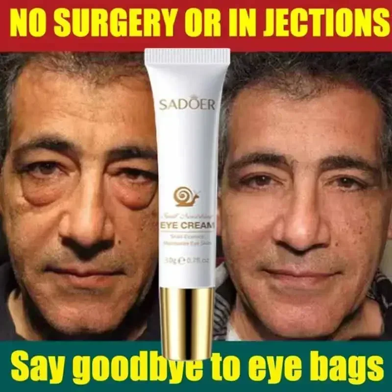 Eye cream anti aging dark circles bags puffiness under eye skin face tightening lift treatment care