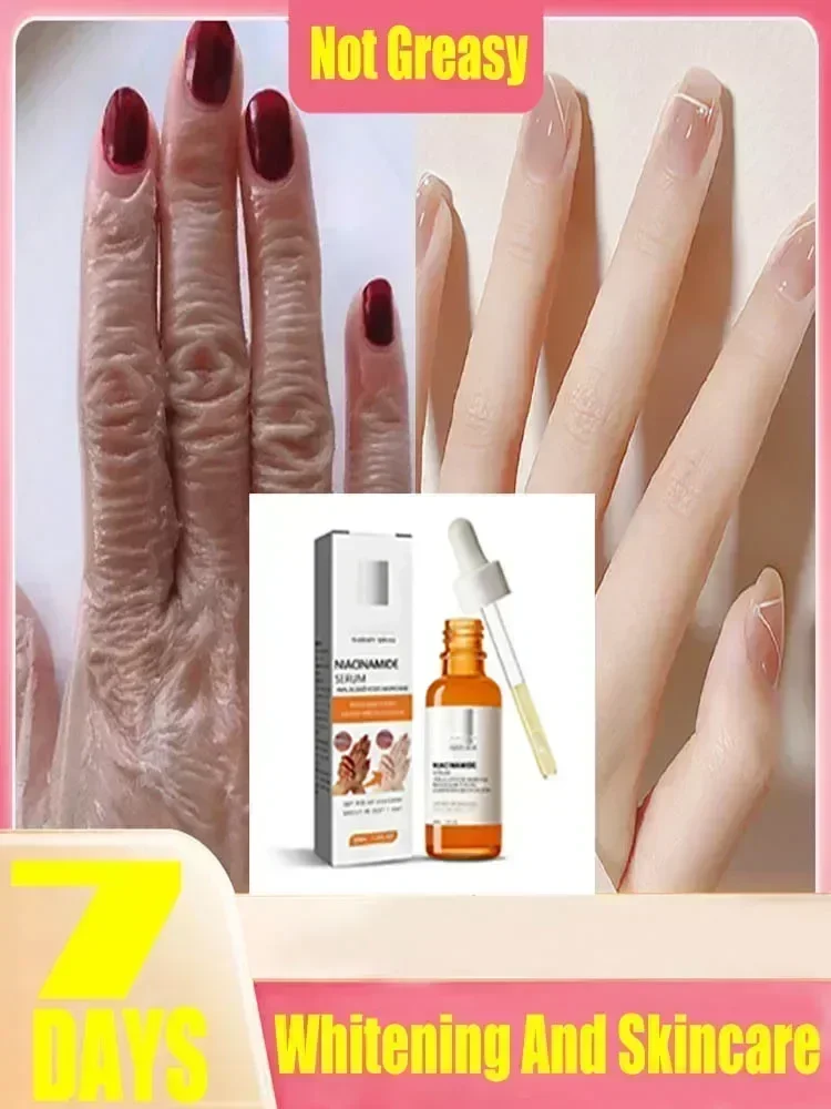 Dark knuckles whitening serum Elbows Armpit Beaching SerumWoman Private Part Skin Removal Dark Knuckles Strong Whitening Serum 2