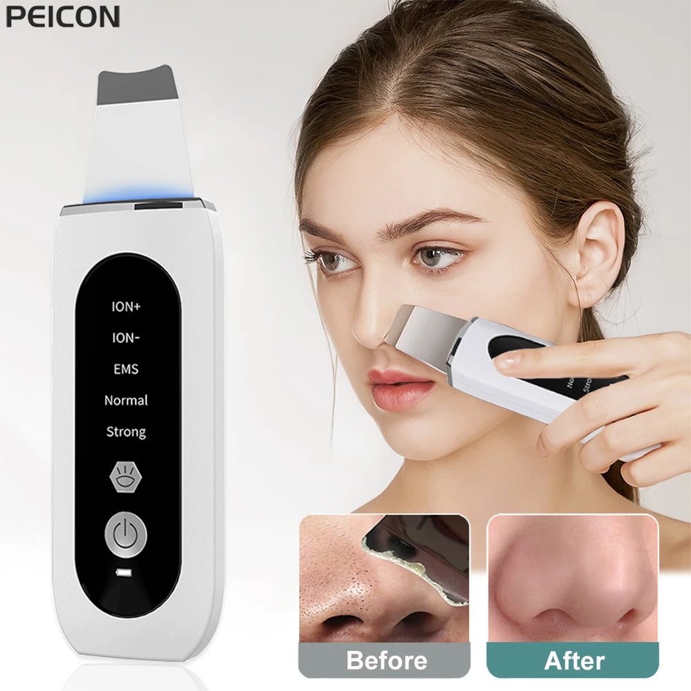 Ultrasonic Skin Scrubber, removedor de cravos, limpeza facial profunda