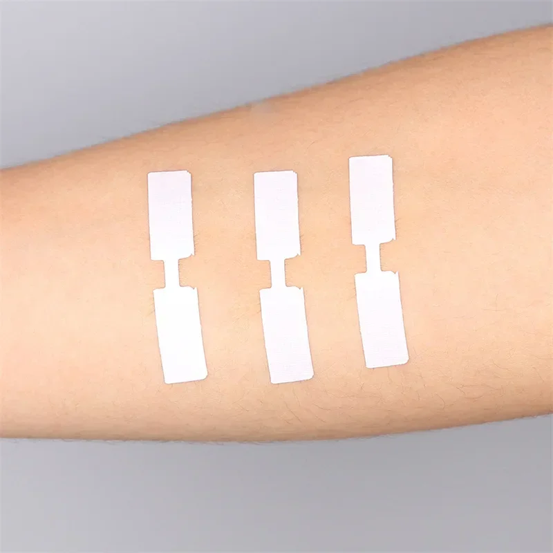 Stitch-Free Adhesive Bandages 4