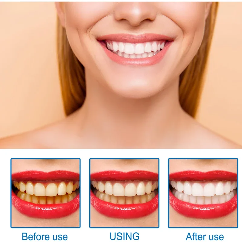 Teeth Cleaner Teeth Whitening Essence Remove Dental Caries Plaque Dirt Serum Fresh Breath Oral Hygiene Dental Tooth Cleaning Tools