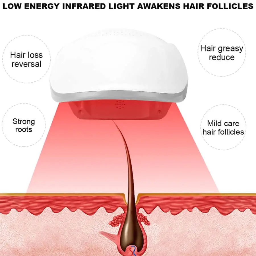 Рисунок 3 - Лазерный рост волос для восстановления