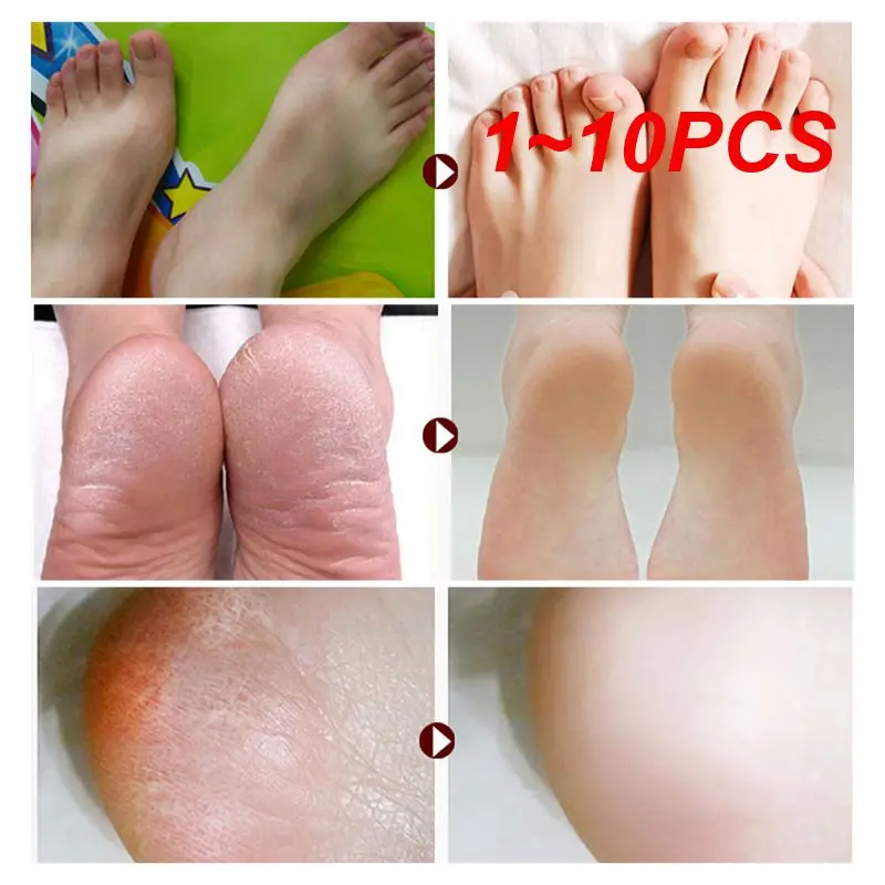 

1~10PCS Manicure Foot Care File Set Dead Hard Skin Callus Remover Scraper Professional Pedicure Tool Rasp Grinding Feet Care