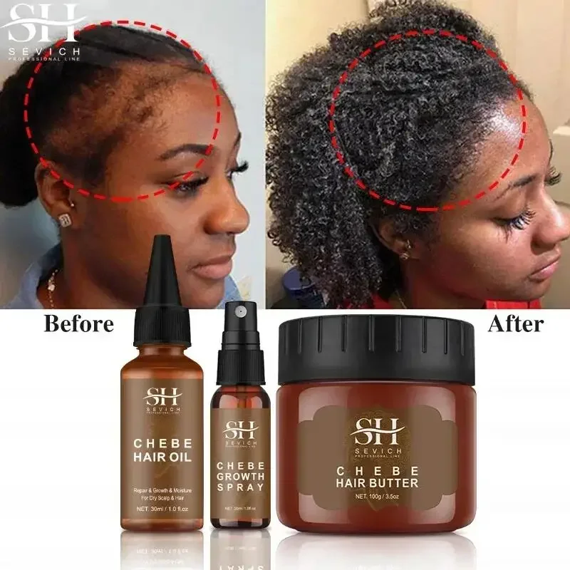 

Fast Hair Growth Set African Chebe Oil Traction Alopecia Hair Mask Anti Break Loss Spray Baldness Treatment Roots Care Products