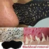 10pcs Nose Strips For Blackheads Acne Removal Instant Pore Unclogging Strips Deep Cleansing Nose Clean Patch New 2