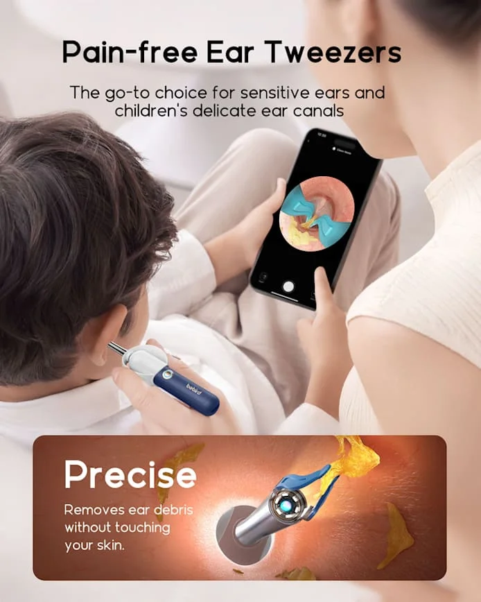 Bebird Visual Earwax Removal Kit With Hd Camera And Tweezers_voghion.com