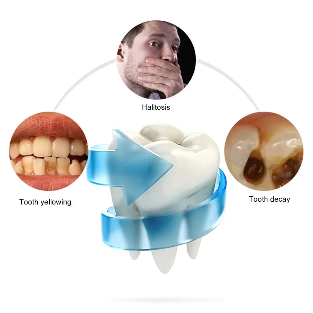 실리콘 초음파 360도 U자형 칫솔, 지능형 USB 충전 및 방수 기능으로 치아 미백 효과 제공