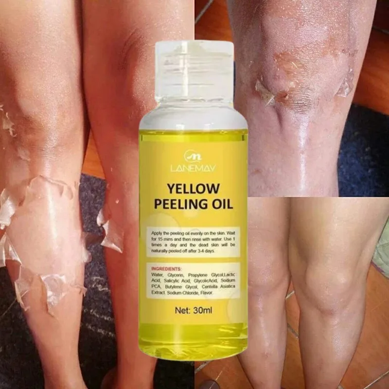 

Yellow Peeling Oil Dark Skin Bleaching Remove Arm Knee Legs Melanin Body Brighten Scrub Exfoliating Dead Skin Care Whiten Serum