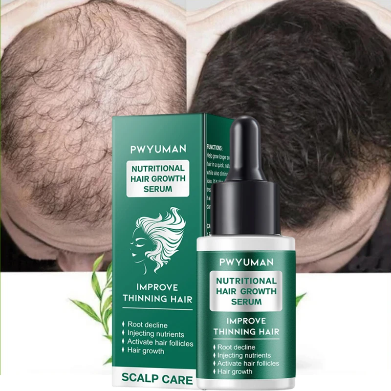 

Ginger Hair Growth Product Anti-loss Hair Regrowth Serum Oil Fast Grow Prevent Baldness Treatment Alopecia Men Women Hair Care
