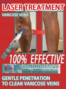 Laser Therapy Leg Repair Pen Reduce Imcomfortable For Legs Improving Blood Circulation Varicose Veins Pen Skin Care Product