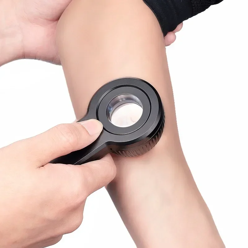 

Medical Dermatoscope for Dermatology, USB Rechargeable LED Dermatoscope for Skin Lesion Research Digital Dermatoscope