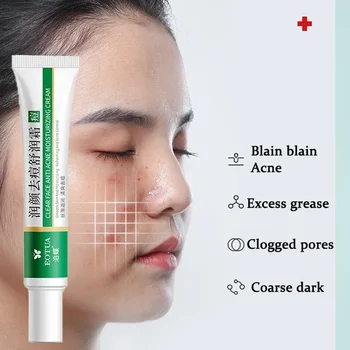 Face Anti-acne Moisturizing Cream Remove Blackhead Oil Control Treatment Repair Pimple Whitening Facial Cream Skin Beauty Care - Thumbnail 5