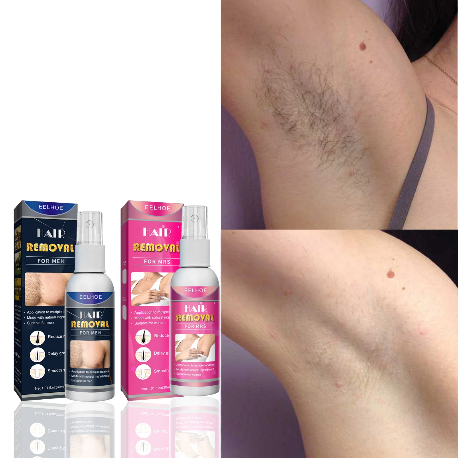 Tips Overtake Brave Permanent Hair Removal Spray Painless epilator de crista Growth Inhibitor  Armpit Leg Arm Hair Depilatory Cream for Men Women| | - AliExpress