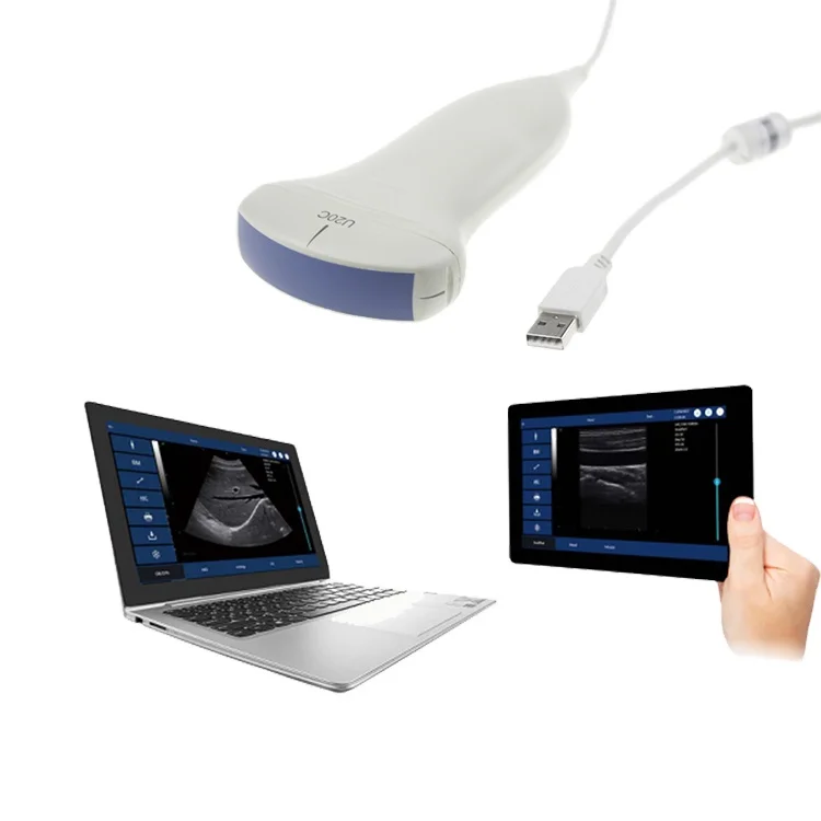 

Бесплатная доставка, улучшенная диагностика, USB-зонд, ультразвуковой аппарат + бесплатное ультразвуковое программное обеспечение
