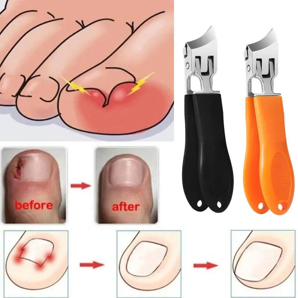 1PC Stainless Steel Nail Clipper Splash-Proof Large Opening Nail Clipper Portable Dead Skin Removal Nail Clipper Cuticle Trimmer 3