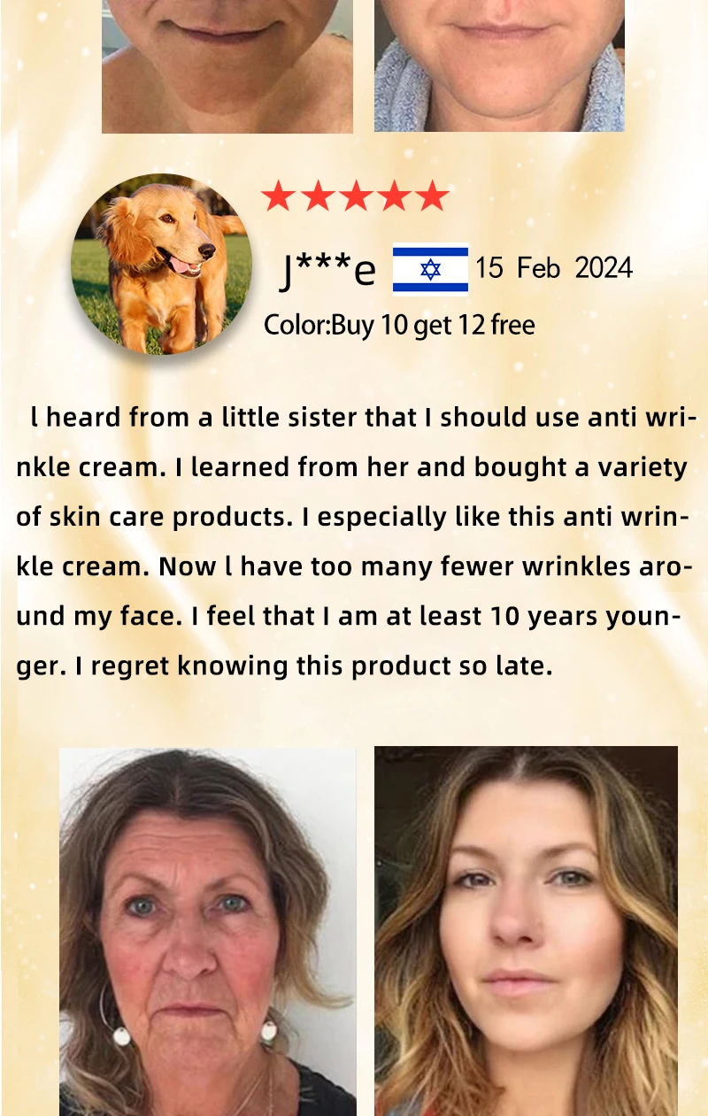 No Fine Lines ,For Wrinkles And Does Not Look Old_voghion.com