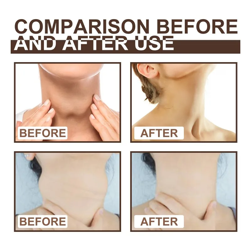Lymphatic detox cream relieve lymph nodes swollenness pain treatment behind ears neck armpit discomfort pain ointment gel
