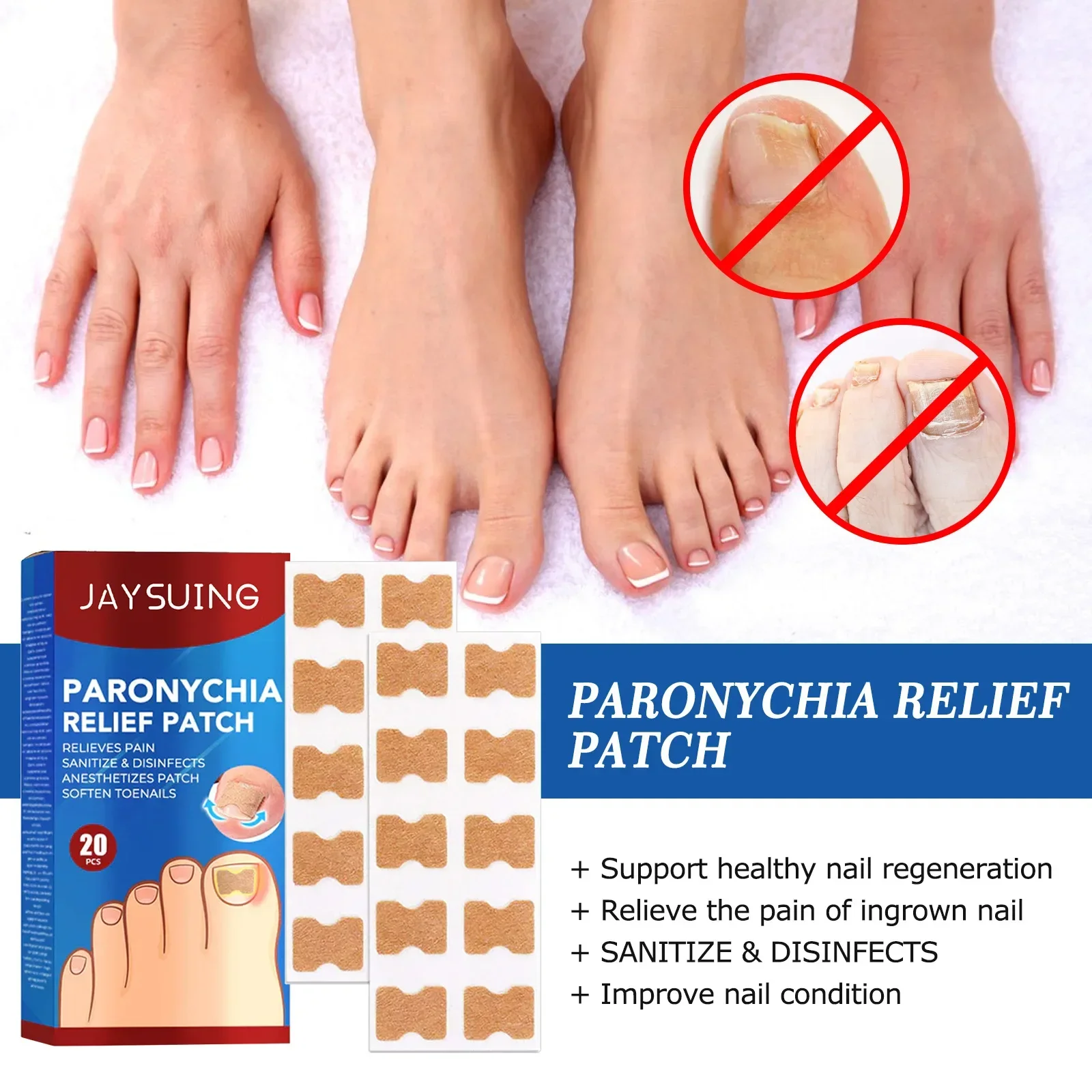 20pcs nail correction stickers ingrown toenail corrector patch waterproof paronychia treatment pedicure tool