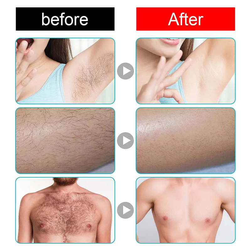 Permanent Hair Removal Cream Painless Intimate Parts Legs Body Armpit Depilatory For Man Women Whitening Body Care Products 50g